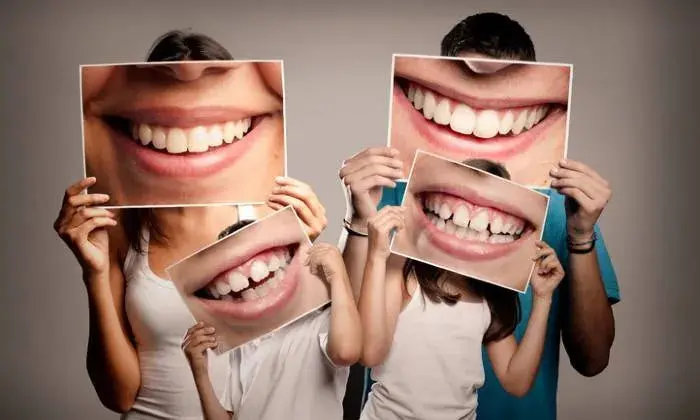 Professional In-Clinic Teeth Whitening – Brighter Smile In One Visit, La Glace Beauty Clinic 1